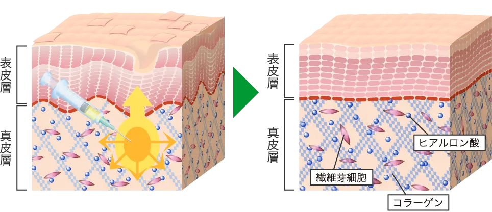 ご自分の肌が再生するから効果が長期に持続！