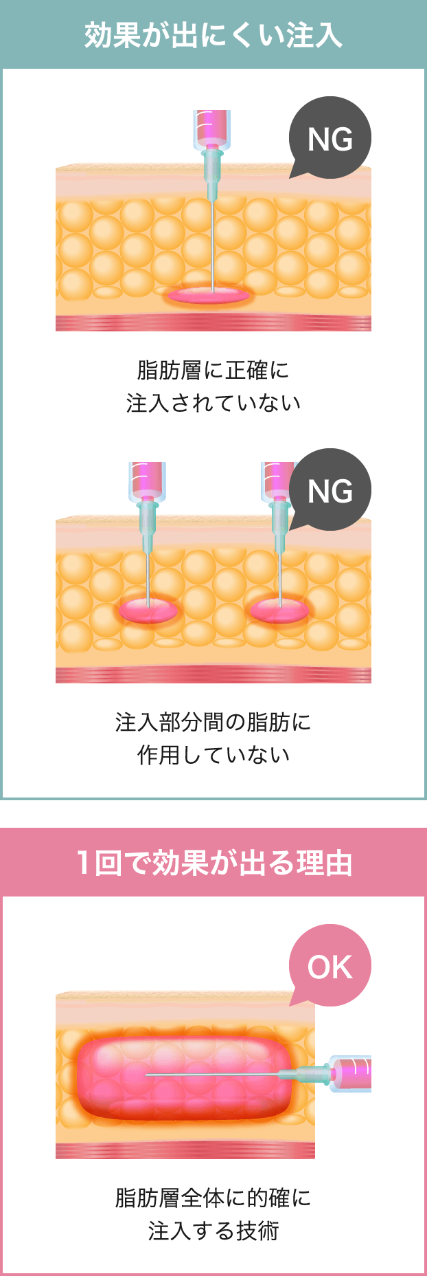 1度で効果を出すための注入技術