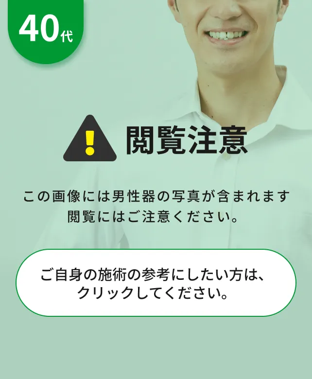 閲覧注意