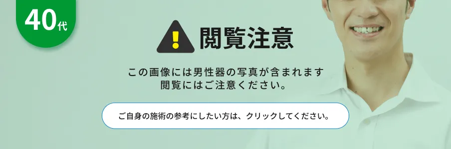 閲覧注意