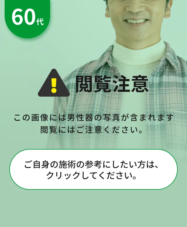 閲覧注意