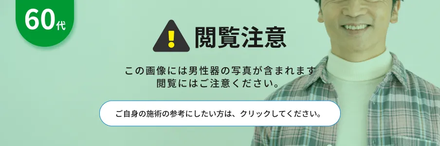閲覧注意