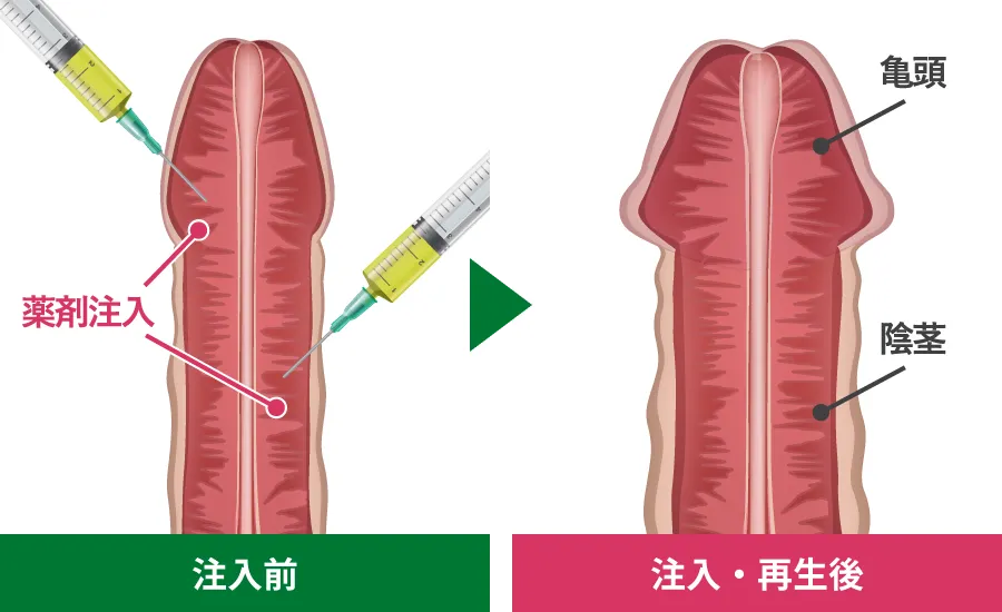 注入前・注入再生後