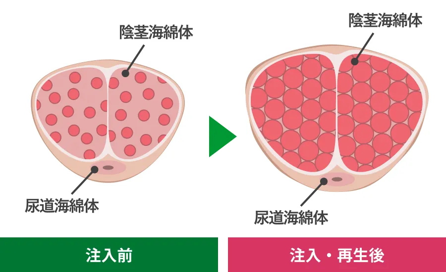 注入前・注入再生後