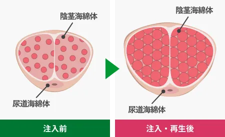 注入前・注入再生後