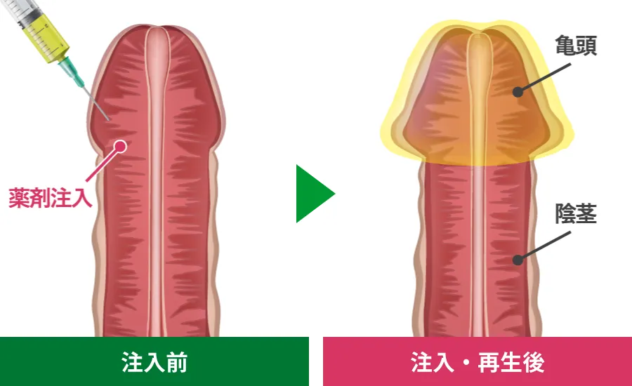 注入前・注入再生後