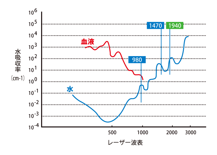 レーザー波表