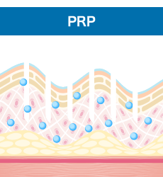 PRPが肌の奥に浸透します。