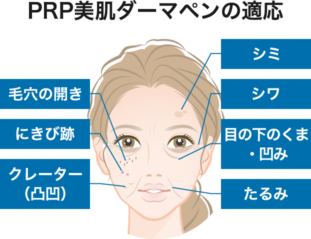 PRP美肌ダーマペンの適応