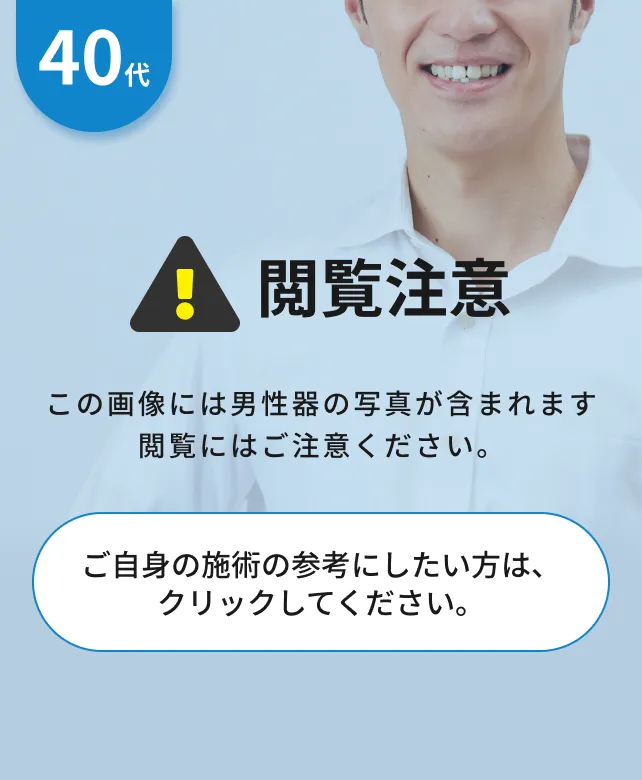 閲覧注意