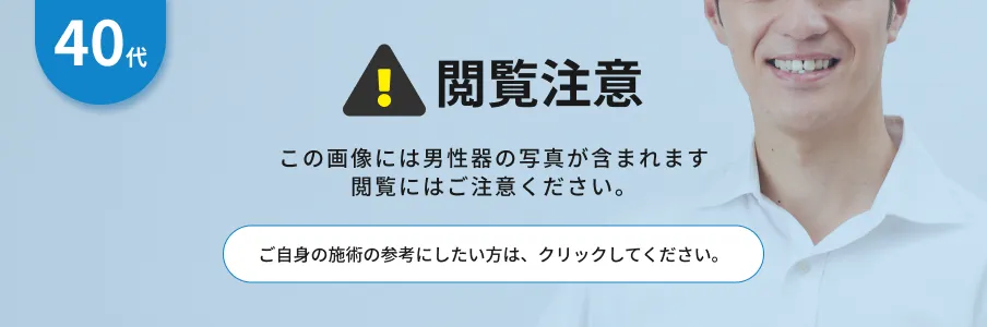 閲覧注意