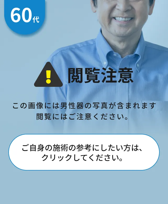 閲覧注意