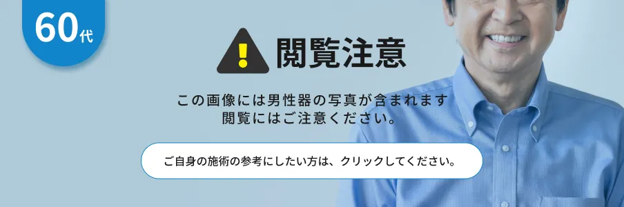 閲覧注意