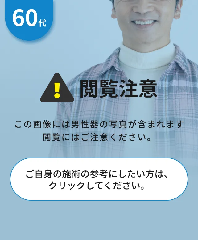 閲覧注意